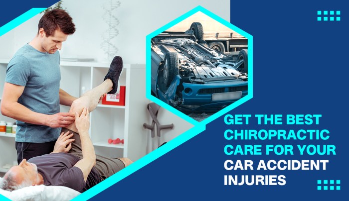 Get the Best Chiropractic Care for Your Car Accident Injuries